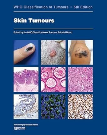 WHO CLASSIFICATION ON TUMOURS  SKIN TUMOURS  5° Edizione in 2 parti