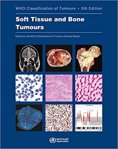 WHO Classification Tumours. Soft Tissue and Bone Tumours