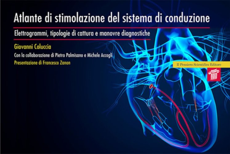 Atlante di stimolazione del sistema di conduzione. Elettrogrammi, tipologie di cattura e manovre diagnostiche