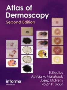 An Atlas of Dermoscopy