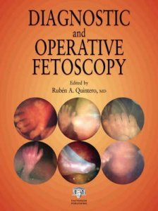 Diagnostic and Operative Fetoscopy