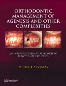 Orthodontic Management of Agenesis and Other Complexities