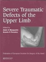 Severe Traumatic Defects of the Upper Limb