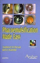 Phacoemulsification Made Easy (With 2 mini - CD-ROM)