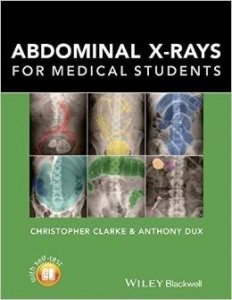 Abdominal X-Rays for Medical Students