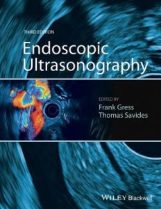 Endoscopic Ultrasonography