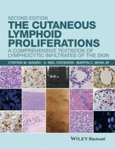 The Cutaneous Lymphoid Proliferations