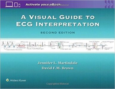 A Visual Guide to ECG Interpretation