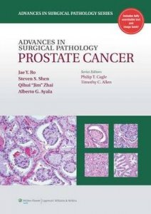 Advances in Surgical Pathology: Prostate Cancer