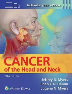 Cancer of the Head and Neck