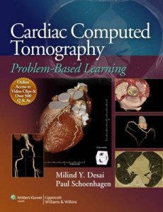 Cardiac Computed Tomography