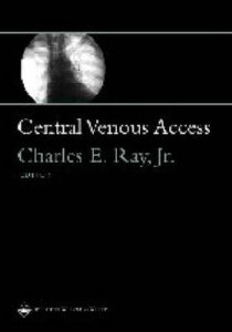 Central Venous Access