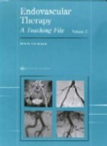 Endovascular Therapy