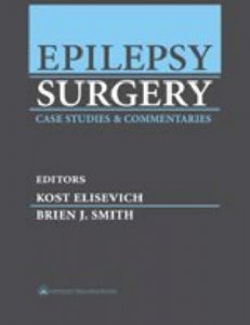 Epilepsy Surgery
