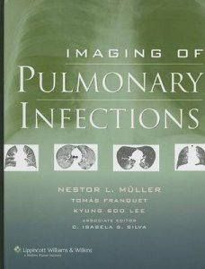 Imaging of Pulmonary Infections
