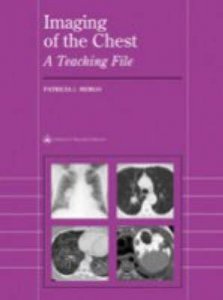 Imaging of the Chest