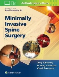 Minimally Invasive Spine Surgery
