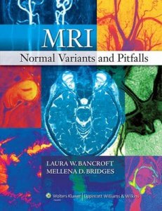 MRI Normal Variants and Pitfalls