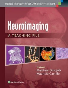 Neuroimaging