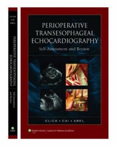 Perioperative Transesophageal Echocardiography Self-assessment and Review