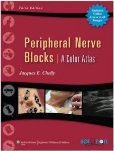 Peripheral Nerve Blocks