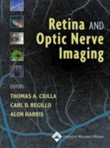 Retina and Optic Nerve Imaging