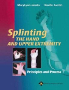 Splinting the Hand and Upper Extremity