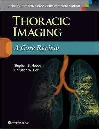 Thoracic Imaging: A Core Review