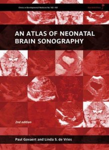 Atlas of Neonatal Brain Sonography