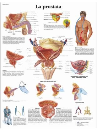 La Prostata