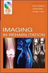 Imaging in Rehabilitation