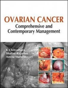 Ovarian Cancer