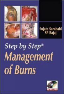 Step by Step Management of Burns