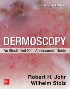 Dermoscopy: an illustrated self-assessment guide