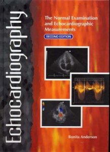 Echocardiography