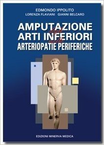 Amputazione degli arti inferiori nelle arteriopatie periferiche