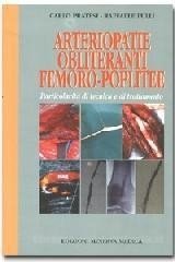 Arteriopatie obliteranti femoro-poplitee. Particolarità di tecnica e di trattamento