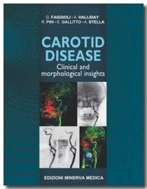 Carotid Disease