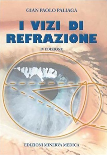 I vizi di refrazione