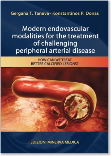 Modern endovascular modalities for the treatment of challenging peripheral arterial disease. How can we treat better calcified lesions?