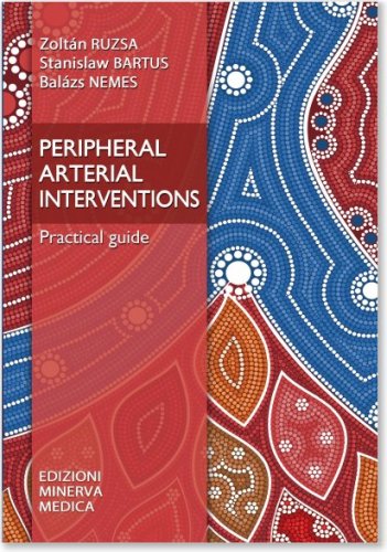 Peripheral arterial interventions. Practical guide