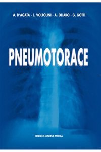 Pneumotorace