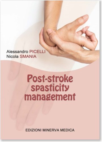 Post-stroke spasticity management