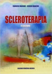Scleroterapia