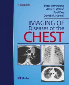 Imaging of Diseases of the Chest