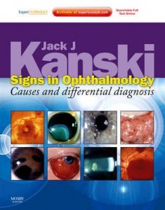 Signs in Ophthalmology: Causes and Differential Diagnosis