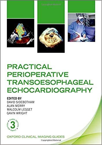 Practical Perioperative Transoesophageal Echocardiography