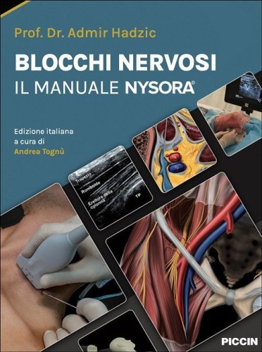 Blocchi nervosi. Il manuale Nysora©