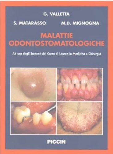 Malattie odontostomatologiche