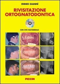 Rivisitazione ortognatodontica